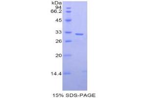 SDS-PAGE analysis of Human MP1 Protein. (PITRM1 Protein)