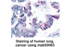Image no. 1 for anti-Baculoviral IAP Repeat-Containing 5 (BIRC5) antibody (ABIN363217) (Survivin antibody)