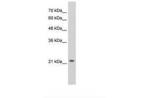 Image no. 3 for anti-Distal-Less Homeobox Protein 2 (DLX2) (AA 238-287) antibody (ABIN203372) (DLX2 antibody  (AA 238-287))