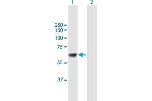 Western Blot analysis of UGT1A9 expression in transfected 293T cell line by UGT1A9 MaxPab polyclonal antibody.