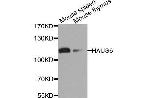 Western blot analysis of extract of mouse spleen and mouse thymus cells, using HAUS6 antibody. (FAM29A antibody)