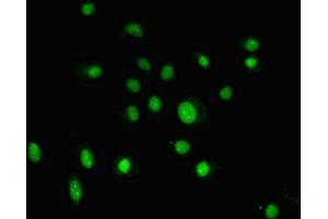 Immunofluorescent analysis of HepG2 cells using ABIN7153807 at dilution of 1:100 and Alexa Fluor 488-congugated AffiniPure Goat Anti-Rabbit IgG(H+L) (GTF2H5 antibody  (AA 1-71))
