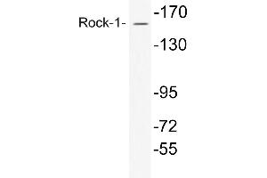 Western blot (WB) analysis of Rock-1 antibody in extracts from COS7 cells. (ROCK1 antibody)