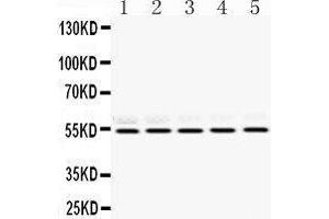 Western Blotting (WB) image for anti-Retinoblastoma Binding Protein 4 (RBBP4) (AA 395-425), (C-Term) antibody (ABIN3043920) (Retinoblastoma Binding Protein 4 antibody  (C-Term))