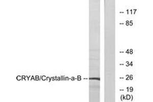 Western blot analysis of extracts from 293 cells, using CRYAB (Ab-19) Antibody. (CRYAB antibody  (AA 10-59))