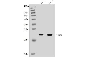 Western blot analysis of Claudin 3/CLDN3 using anti-Claudin 3/CLDN3 antibody (ABIN7599626).