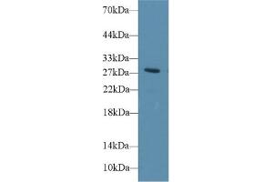 Western Blotting (WB) image for anti-Deiodinase, Iodothyronine, Type III (DIO3) (AA 37-169) antibody (ABIN7436198)
