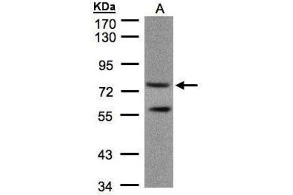 PDE4C antibody