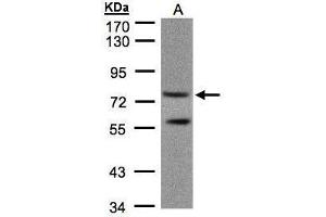 WB Image Sample(30 μg of whole cell lysate) A:293T 7. (PDE4C antibody)
