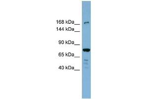 WB Suggested Anti-DAPK1 Antibody Titration: 0. (DAP Kinase 1 antibody  (N-Term))
