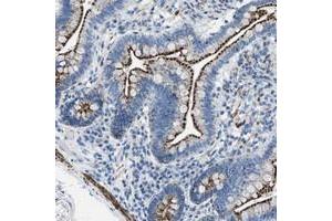 Immunohistochemical staining of human small intestine with TMEM180 polyclonal antibody  shows distinct granular cytoplasmic positivity in glandular cells at 1:20-1:50 dilution. (TMEM180 antibody)