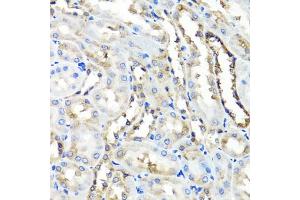 Immunohistochemistry of paraffin-embedded rat kidney using HYAL1 antibody (ABIN5975045) at dilution of 1/100 (40x lens). (HYAL1 antibody)