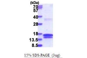 Uridine-Cytidine Kinase 1 (UCK1) (AA 143-273) protein (His tag)