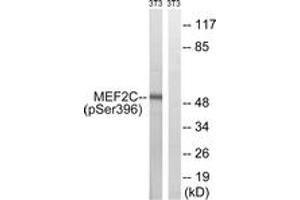 Western blot analysis of extracts from NIH-3T3 cells treated with starved 24h, using MEF2C (Phospho-Ser396) Antibody. (MEF2C antibody  (pSer396))