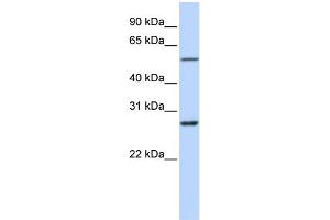 WB Suggested Anti-RNF217 Antibody Titration:  0. (RNF217 antibody  (Middle Region))