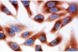 Anti-Calpain 1 antibody, ICC ICC: HELA Cell (CAPNL1 antibody  (Middle Region))