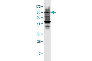 Western Blot detection against Immunogen (98. (RARS antibody  (AA 1-660))