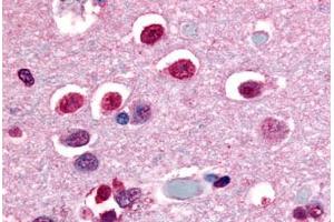 Anti-NR4A3 antibody  ABIN1049142 IHC staining of human brain, neurons and glia. (NR4A3 antibody  (C-Term))