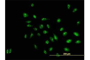 Immunofluorescence of purified MaxPab antibody to D21S2056E on HeLa cell.