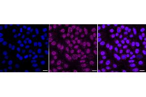 anti-Arrestin, beta 1 (ARRB1) antibody