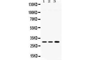 Western blot analysis of AQP11 expression in rat brain extract ( Lane 1), mouse brain extract ( Lane 2) and HELA whole cell lysates ( Lane 3).
