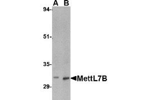 Western Blotting (WB) image for anti-Methyltransferase Like 7B (METTL7B) (C-Term) antibody (ABIN1030517)