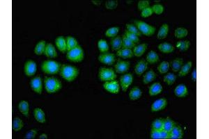 Immunofluorescent analysis of A549 cells using ABIN7163557 at dilution of 1:100 and Alexa Fluor 488-congugated AffiniPure Goat Anti-Rabbit IgG(H+L) (LCP1 antibody  (AA 2-627))