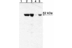 Western blot analysis of T-bet expressed by Mouse Th1 and Th2 cells and Human NK cell and T cell leukemia lines and Peripheral Blood Mononuclear Cells (PBMC). (T-Bet antibody)
