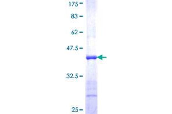 NR1H4 Protein (AA 363-472) (GST tag)