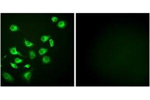 Immunofluorescence analysis of HepG2 cells, using GRP94 Antibody. (GRP94 antibody  (AA 754-803))