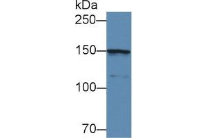 Western Blot; Sample: Mouse Cerebrum lysate; Primary Ab: 3µg/ml Rabbit Anti-Human COL4a5 Antibody Second Ab: 0.