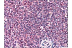 Human Spleen (formalin-fixed, paraffin-embedded) stained with CARD11at 2 µg/ml followed by biotinylated anti-goat IgG secondary antibody, alkaline phosphatase-streptavidin and chromogen. (CARD11 antibody  (C-Term))