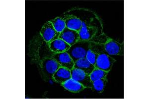 Confocal Immunofluorescent analysis of A431 cells using AF488-labeled EGFR Monoclonal Antibody (GFR450) (Green). (EGFR antibody  (Extracellular Domain))