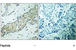 Image no. 2 for anti-Histone Deacetylase 5 (HDAC5) (AA 496-500) antibody (ABIN197341) (HDAC5 antibody  (AA 496-500))