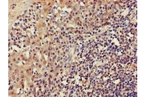 Immunohistochemistry of paraffin-embedded human tonsil tissue using ABIN7165618 at dilution of 1:100 (C22orf13 antibody  (AA 1-136))