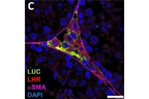 Immunofluorescence (Paraffin-embedded Sections) (IF (p)) image for anti-Luteinizing Hormone/Choriogonadotropin Receptor (LHCGR) (C-Term) antibody (ABIN2857013)
