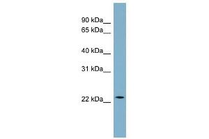 CCDC25 antibody used at 1 ug/ml to detect target protein. (CCDC25 antibody  (Middle Region))