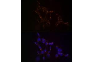 Immunofluorescence analysis of NIH/3T3 cells using USO1 Rabbit mAb (ABIN7271234) at dilution of 1:100 (40x lens). (USO1 antibody)