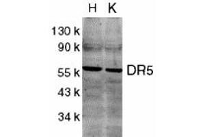 Western Blotting (WB) image for anti-Tumor Necrosis Factor Receptor Superfamily, Member 10b (TNFRSF10B) (C-Term) antibody (ABIN1030367) (TNFRSF10B antibody  (C-Term))