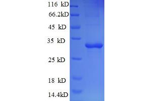SDS-PAGE (SDS) image for Tryptase alpha/beta 1 (TPSAB1) (AA 11-243), (partial) protein (His tag) (ABIN5713028)