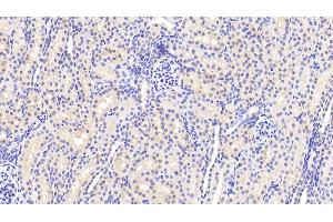 Detection of ANXA3 in Human Kidney Tissue using Polyclonal Antibody to Annexin A3 (ANXA3) (Annexin A3 antibody  (AA 26-160))