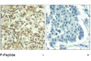 Image no. 1 for anti-V-Akt Murine Thymoma Viral Oncogene Homolog 1 (AKT1) (pThr450) antibody (ABIN319272) (AKT1 antibody  (pThr450))
