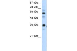 Western Blotting (WB) image for anti-RNA Pseudouridylate Synthase Domain Containing 2 (RPUSD2) antibody (ABIN2462340) (RPUSD2 antibody)