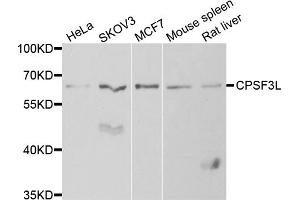 Western blot analysis of extracts of various cell lines, using CPSF3L antibody (ABIN5973943) at 1/1000 dilution.