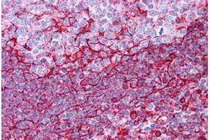 Human Tonsil: Formalin-Fixed, Paraffin-Embedded (FFPE) (Vimentin antibody  (C-Term))