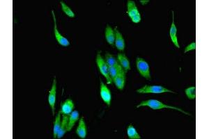 Immunofluorescent analysis of Hela cells using ABIN7159469 at dilution of 1:100 and Alexa Fluor 488-congugated AffiniPure Goat Anti-Rabbit IgG(H+L) (MPPED1 antibody  (AA 1-326))