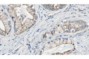 ABIN6277747 at 1/100 staining Human prostate tissue by IHC-P. (IRS2 antibody  (C-Term))