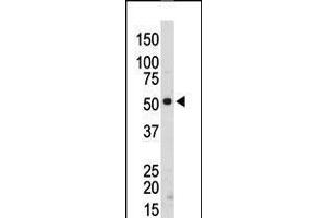 Antibody is used in Western blot to detect SRMS in mouse kidney tissue lysate. (SRMS antibody  (C-Term))