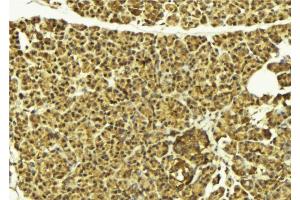 ABIN6269396 at 1/100 staining Mouse pancreas tissue by IHC-P. (HDAC8 antibody  (N-Term))