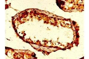 Immunohistochemistry (IHC) image for anti-Ubiquitin A-52 Residue Ribosomal Protein Fusion Product 1 (UBA52) (AA 1-128) antibody (ABIN7174409)